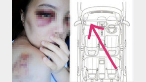 멍투성이 여성의 신신당부 “잠든 사이 순식간에…뒷좌석도 안전벨트 필수”