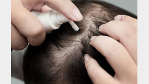 성인 10명 중 3명 “탈모 경험”…중장년 남성만의 고민 아니다