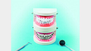 설측-세라믹 등 다양한 치아교정법… 나에게 맞는 치료법 고르려면? 