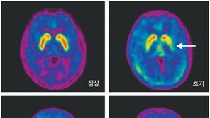 [제약계소식]듀켐바이오 “방사성의약품으로 파킨슨병 조기 진단”
