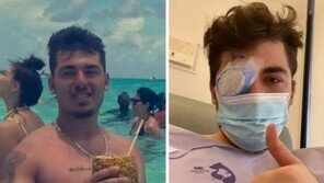 “렌즈 낀 채 잠들지 마”…매년 500명 시력 잃어