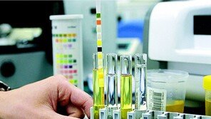 소변이 붉은색이고 옆구리 통증 있다면 요로결석 의심을