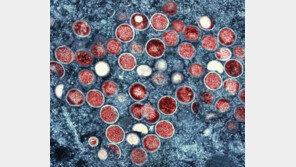 엠폭스 국내감염 3명 늘어 총 13명… ‘2차 감염’도 첫 확인