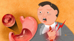 65세 이상 남성 다발성 위암 위험 높다…“개수보다 형태 중요”