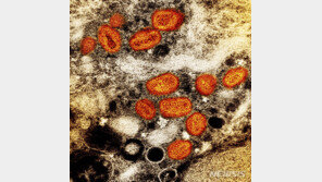 엠폭스 확진자 10명 급증…“모두 국내서 감염”