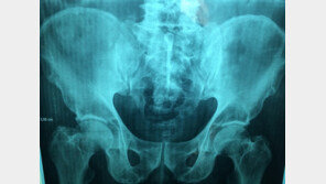 ‘시치미 뚝’…금목걸이 훔쳐 홀랑 집어삼킨 브라질 10대