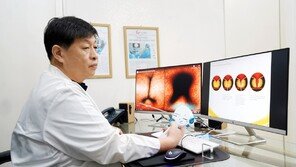 안전한 전립샘비대증 시술… 90세 이상 초고령자도 가능