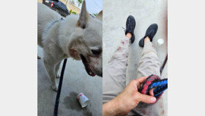 목줄 풀린 핏불 미친듯 공격, 진돗개·견주 피투성이…“간신히 살았다”