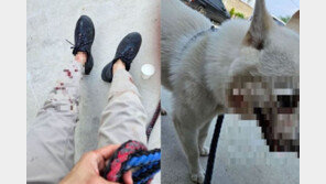 “간신히 살렸다”…목줄 풀린 맹견이 진돗개 공격