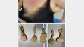 “저 여자 몸이 왜 저래?”…뱀 5마리 속옷서 ‘꿈틀’ 中세관 적발