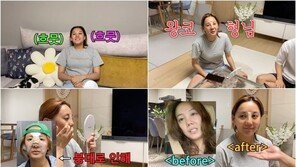 고은아 “코 수술 후 내 얼굴 어색…2차 수술할 것”