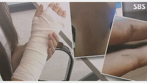 “부모, 사과 한마디 없어” 초등 제자에 폭행당한 교사 남편