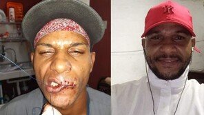 쿠바 래퍼 입술 꿰매…“예술가 정치범으로 탄압 말라”