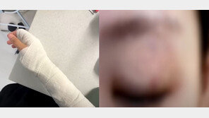 “학부모가 아내 탓만”…초6에 폭행당한 여교사 남편의 분노