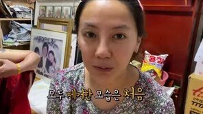 고은아, 코 재수술후 모습 처음 공개…“아직 얼굴 부어있다”