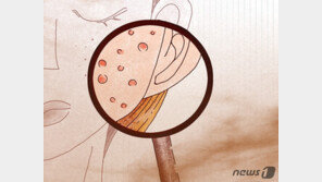 여드름 환자 5명 중 3명은 20~30대…“스트레스 피하고 흡연·음주 삼가야”