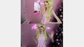 거식증 홍보 ‘170㎝·39㎏’ 유튜버…213만 구독자 “뼈만 남아 위험, 계정 패쇄하라”