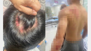 “운동하던 중3 아들, 흉기난동범 오인받아 피범벅되고 수갑까지”