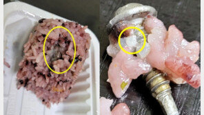 식당 밥서 나사 나와 앞니 깨졌는데…사장 “누가 밥을 앞니로 먹냐” 의심