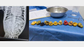 아픈 반려견 中병원 데려갔더니…뱃속에 ‘오리인형 11개’