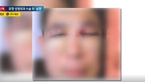 강남 유명 성형외과서 눈밑지방 수술받은 50대…하루만에 실명