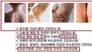 화장품으로 등드름 치료?…“거짓말에 지갑 열지 마세요”