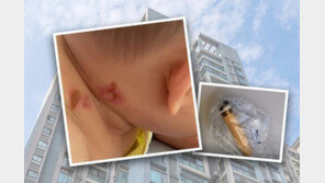 고층건물서 담배꽁초 휙…지나가던 4개월 여아 화상 ‘날벼락’