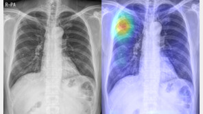 휴대용 엑스레이 강자… 소프트웨어-하드웨어 접목해 세계시장 ‘노크’ 