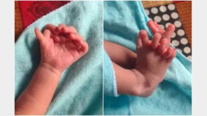 인도서 손·발가락 26개 女 태어나…부모 “신의 재림”