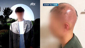 “온갖 일 다 시켜”…20대 요양원 공익, 한 달 만에 온몸 털 다 빠졌다