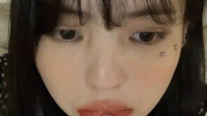 한소희, 입술→눈 밑 피어싱 공개 “부어서 말 어눌…흉터 걱정 안해”