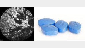 발기부전치료제 먹은 30대男…3시간 뒤 ‘실명’