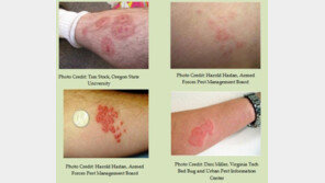 “침대·가구 틈 ‘빈대’ 주의…영국·프랑스 방문 후 여행용품 소독할 것”