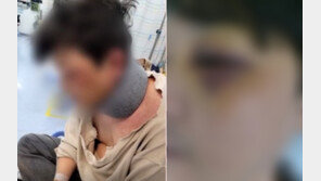 애들 싸움이 아빠 싸움으로…아들 앞서 무자비 폭행당해 전치 5주