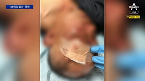 “딸 같아서 나섰다”…폭행당하는 편의점 알바생 돕다 물어뜯긴 50대