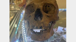 “가짜가 아니었다”…인간 두개골 美 중고상점서 발견