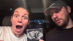 자궁 2개에 쌍둥이 딸 1명씩 임신한 여성…‘100만분의1 확률’