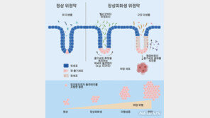 위암 발병위험 6배 높이는 ‘이것’…유전자변이 규명했다