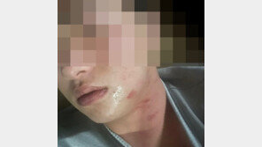 김하성에 고소당한 후배 야구선수 “폭행 직후 사진”…언론에 공개