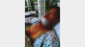 식당서 혼밥하던 30대 장애인 불러내…무차별 폭행한 10대들