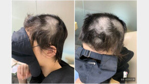 ‘바리캉 폭행남’ 변호사 “이미 벌어진 일, 노여움 풀라”…피해자 부모 울분