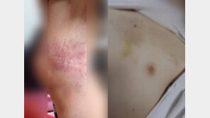 부친상 당했는데 “전화 안 받냐?”…고교생 마구 폭행한 동급생들