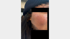 길가던 싱가포르 女유학생 얼굴에 주먹질…30대 남성 검거