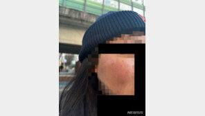 경찰, 대낮 女유학생 폭행 30대 검거…가해자 가족이 제지