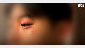 韓관광객, 이탈리아서 폭행당해…외교부 ‘미온적 대응’ 주장 반박