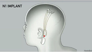 머스크 “인간 뇌에 첫 칩 이식, 생각만으로 컴퓨터 제어…환자 잘 회복 중”