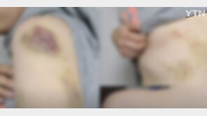 같은 청각장애인들 상대로…폭행·갈취한 20대들 경찰 조사