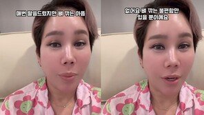 김송, 광대 수술…“뼈 깎는 아픔 없고 불편함만 있어”