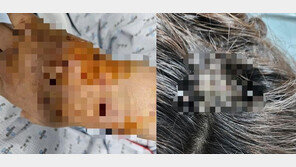 대리기사 맹견에 물려 전치4주…견주는 ‘보고만 있어’