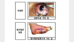 담뱃갑 경고 그림·문구 12월부터 변경…눈 질환·말초혈관 질환 내용 추가